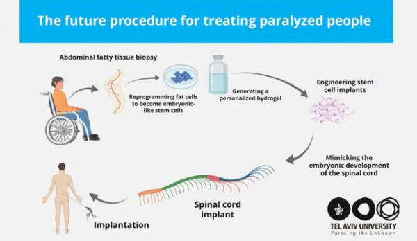 3D printing spinal cord tissue offers new hope for repairing spinal cord injuries