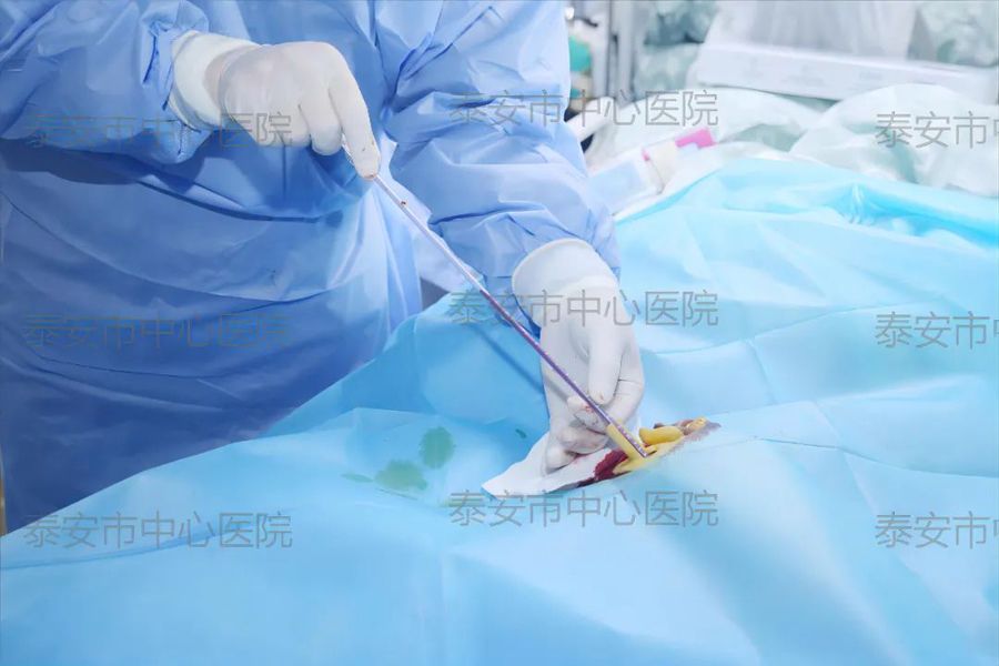 Shandong Tai 'an 3D printing technology adds a new means for puncture treatment of patients with bra